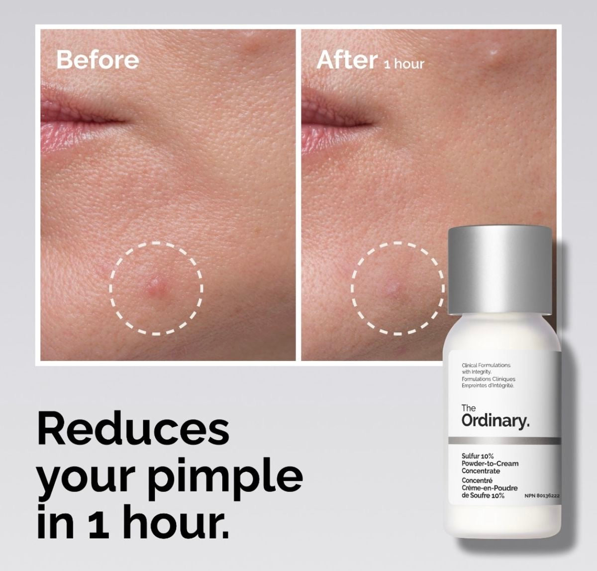 THE ORDINARY] Sulfur 10% Powder-to-Cream Concentrate 30ml