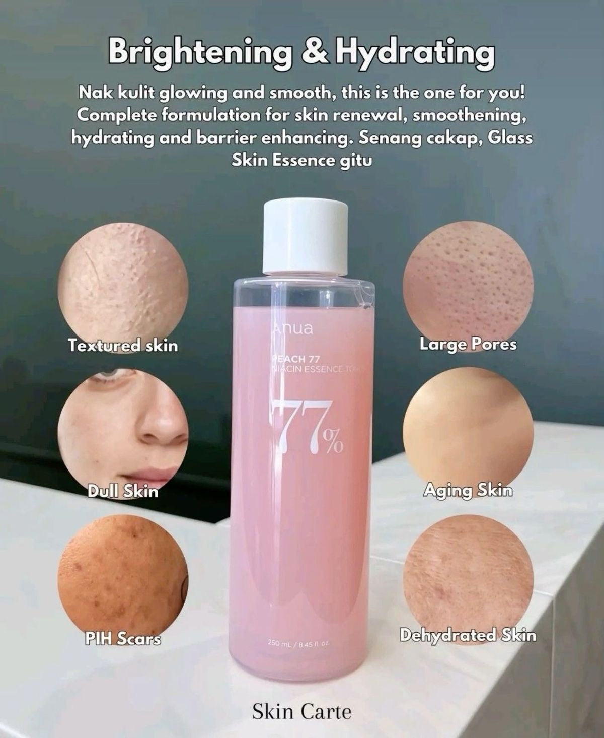 Anua Peach 77 Niacin Essence Toner