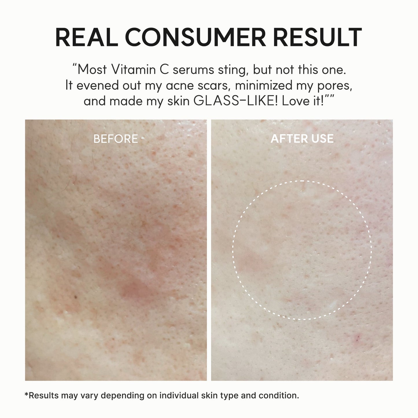 Arencia Vitamin C Booster Shot, Pure Vitamin C + Glutathione for Bright, Healthy Skin Glow